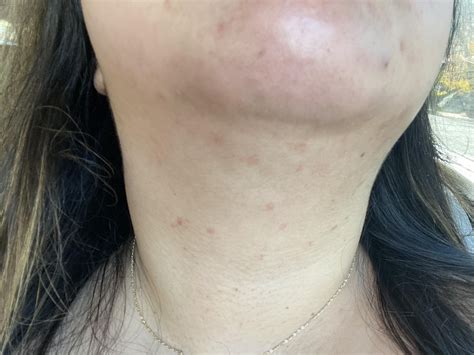 [skin concern] used the same products for two weeks then overnight got this reaction. Allergic