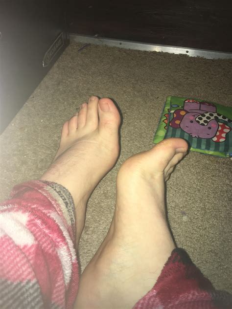 Rate my feet. 1/10 : r/Rate_my_feet