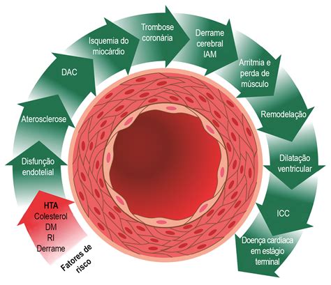 Fisiopatologia Da Hipertensão Arterial Sistêmica - RETOEDU