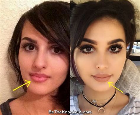 SSSniperwolf Plastic Surgery Comparison Photos