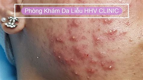 Relax Every Day With #HHV CLINIC | Đỗ Thu Hiền | Hiền Vân Spa 02 - YouTube