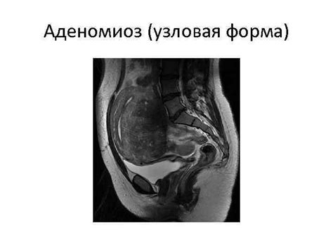 МРТ органов женского малого таза.