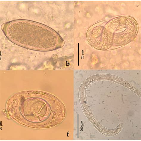 Ascaris Lumbricoides Larvae