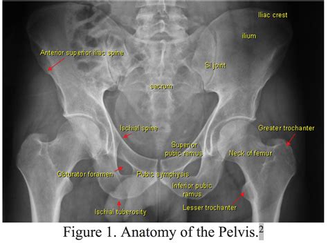 emDOCs.net – Emergency Medicine EducationPelvic fractures: ED ...