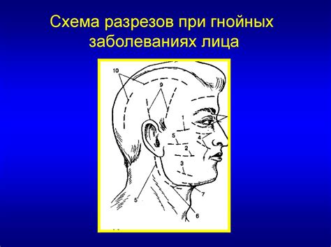 Топографическая анатомия и оперативные вмешательства на голове ...