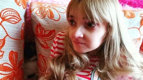 Что известно о жительнице Барнаула, которая весила 17 кг - Толк 19.03.2023
