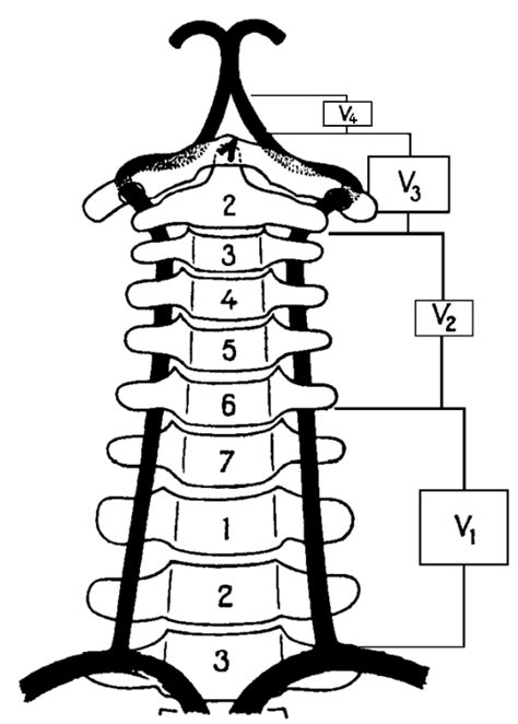 a vertebralis v3 - Google-søgning Clinic, Anatomy, Google, Medicine ...