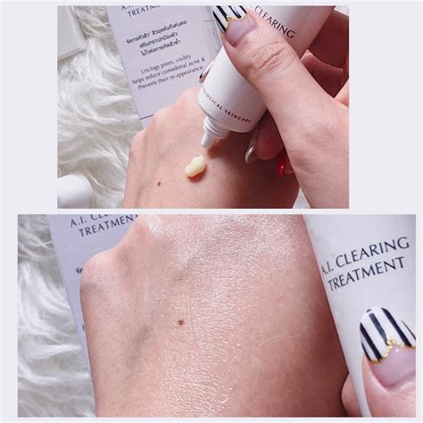 Mini Review: Eucerin ProACNE series - Sherlyn Lifestyle Experience
