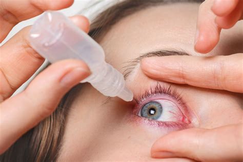 Las mejores gotas para ojo seco