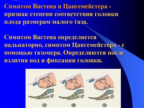 Узкий таз в современном акушерстве. (Лекция 18) - презентация онлайн