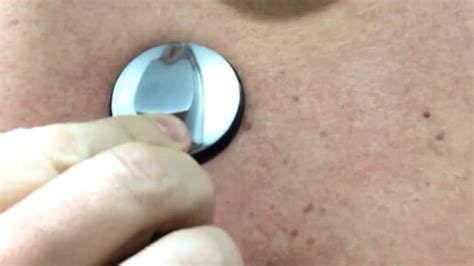 Тоны сердца аускультация стетоскоп stethoscope heart sounds assessment ...