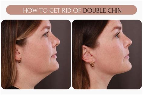 how to get rid of a double chin at home