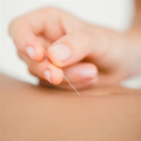 therapies treatments protea acupuncture
