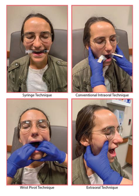 fix  jaw drop mandible dislocation management