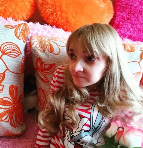 Кристина Корягина, которая весила 17 кг в 27 лет, показала, как ...