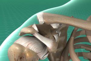 ac joint reconstruction dr ameya  sawarkar