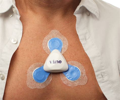 heartbug cardiac monitor cardiac diagnostics melbourne