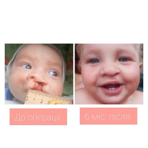 Ця усмішка прилетіла нам з Івано-Франківської області! 👶У малюка ...