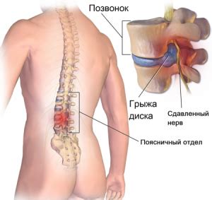 Хонда - лекарство для суставов: инструкция, состав, аналоги