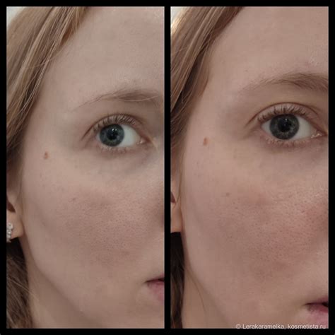 Достойная сыворотка с витамином С Vichy Liftactiv Supreme Vitamin C ...