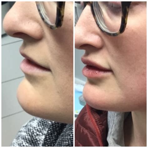 Modern medical facilities will soon be added to the Penobscot County Jail 26