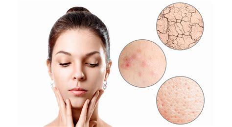 5 Easy Ways to Improve Dry Skin