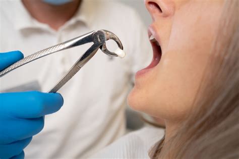 What Should a Tooth Extraction Look Like When Healing?