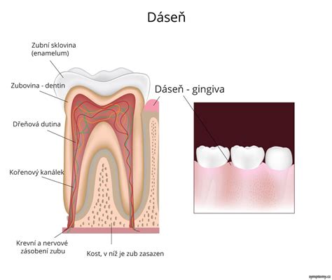 Dáseň - příznaky a léčba
