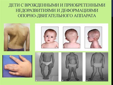 Клинико-психолого-педагогическая характеристика детей с нарушением ...