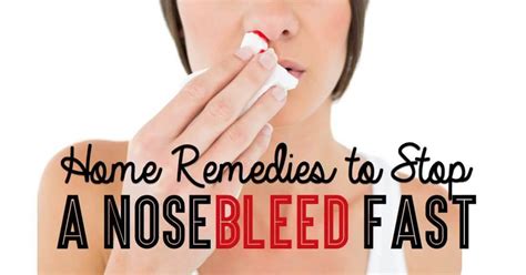 Home Remedies to Stop a Nose bleed Fast