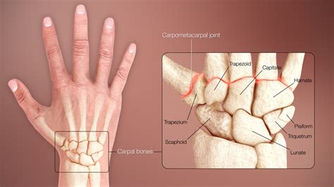 Wrist Injuries Treatment | Aptiva Health