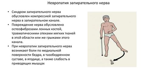Туннельные невропатии нижних конечностей - презентация онлайн
