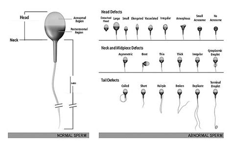 Understanding Sperm Morphology | Carolina Conceptions