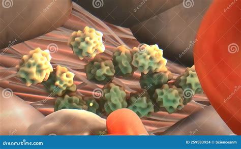 plaque formation   cardiovascular system stock illustration