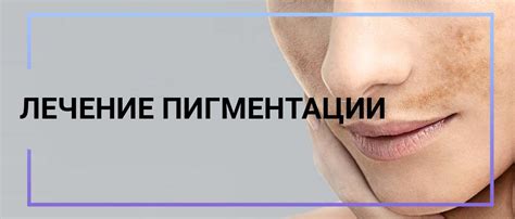 Лечение пигментации на лице: цена в Москве, причины появления