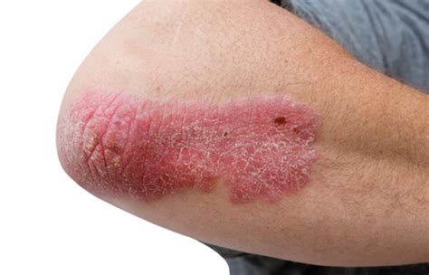 Learning update: Cracking patients' skin conditions