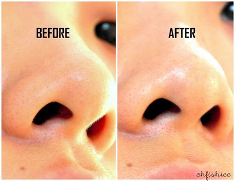 oh{FISH}iee: Review: CIRACLE Blackhead Off Sheet: Goodbye Blackheads!