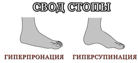 Пронация стопы: как определить + как выбрать кроссовки