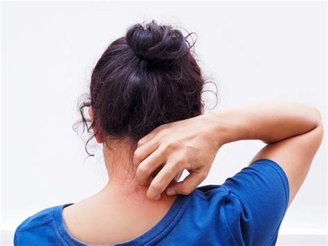 Ringworm Infection: Causes, Symptoms and Prevention Tips