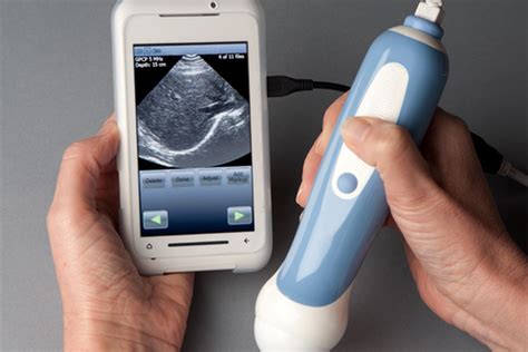 wireless handheld ultrasound  herman dunlap blog