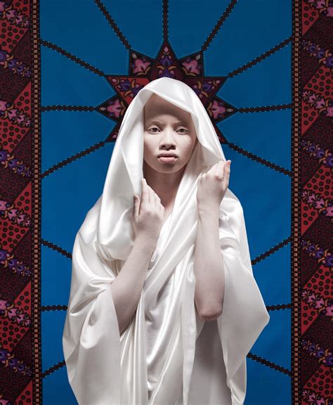 Striking Photos of African Albinism | Moss and Fog