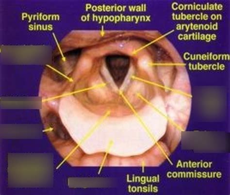 epiglottic inversion  stuart witt blog