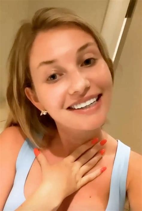 Amy Hart shows off her £100k pearly whites after vile abuse from trolls