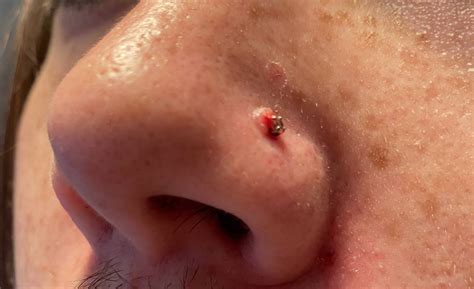 Nose Piercing Bleeding: Causes and Treatment - AuthorityTattoo