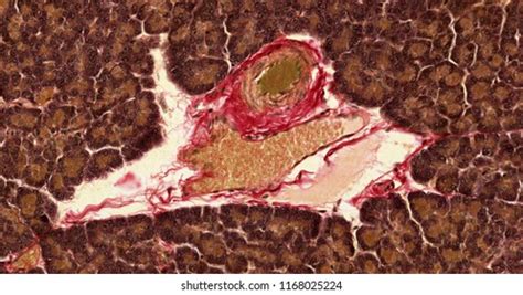 Pancreas Gland Histology Stock Photo 1168025224 | Shutterstock