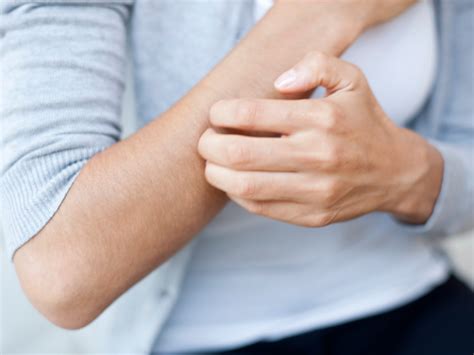 How to deal with itchy skin? - Teller Report