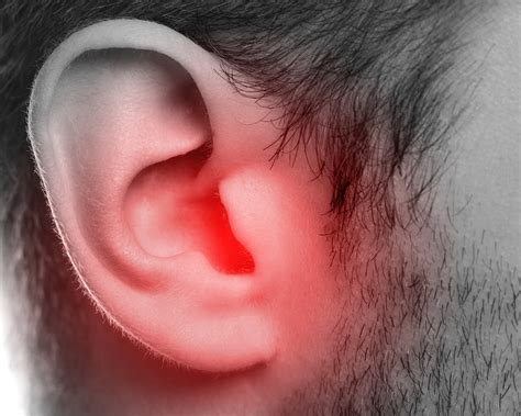What is a Hearing Loss Bone Anchored Hearing Aid? | Hearing Associates ...