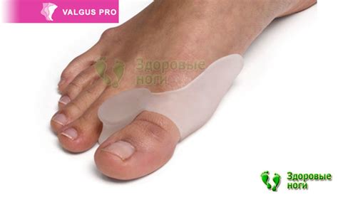 Купить Valgus Pro (Вальгус Про) - ортопедический фиксатор большого ...