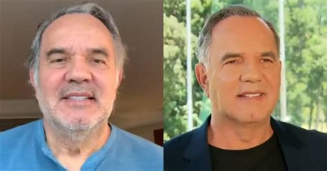 Humberto Martins Antes E Depois - Humberto Martins revela resultado de harmonização facial