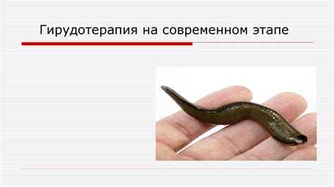 Гирудотерапия на современном этапе - презентация онлайн